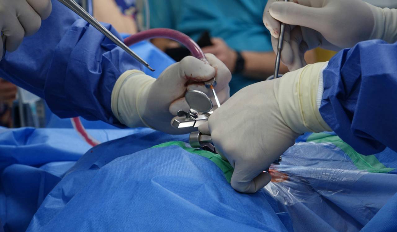 Medical professionals in an operating room performing a laparoscopic procedure